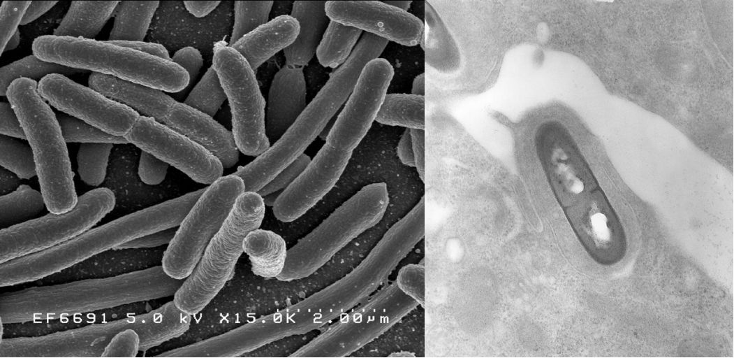 The Evolution of Virulence
