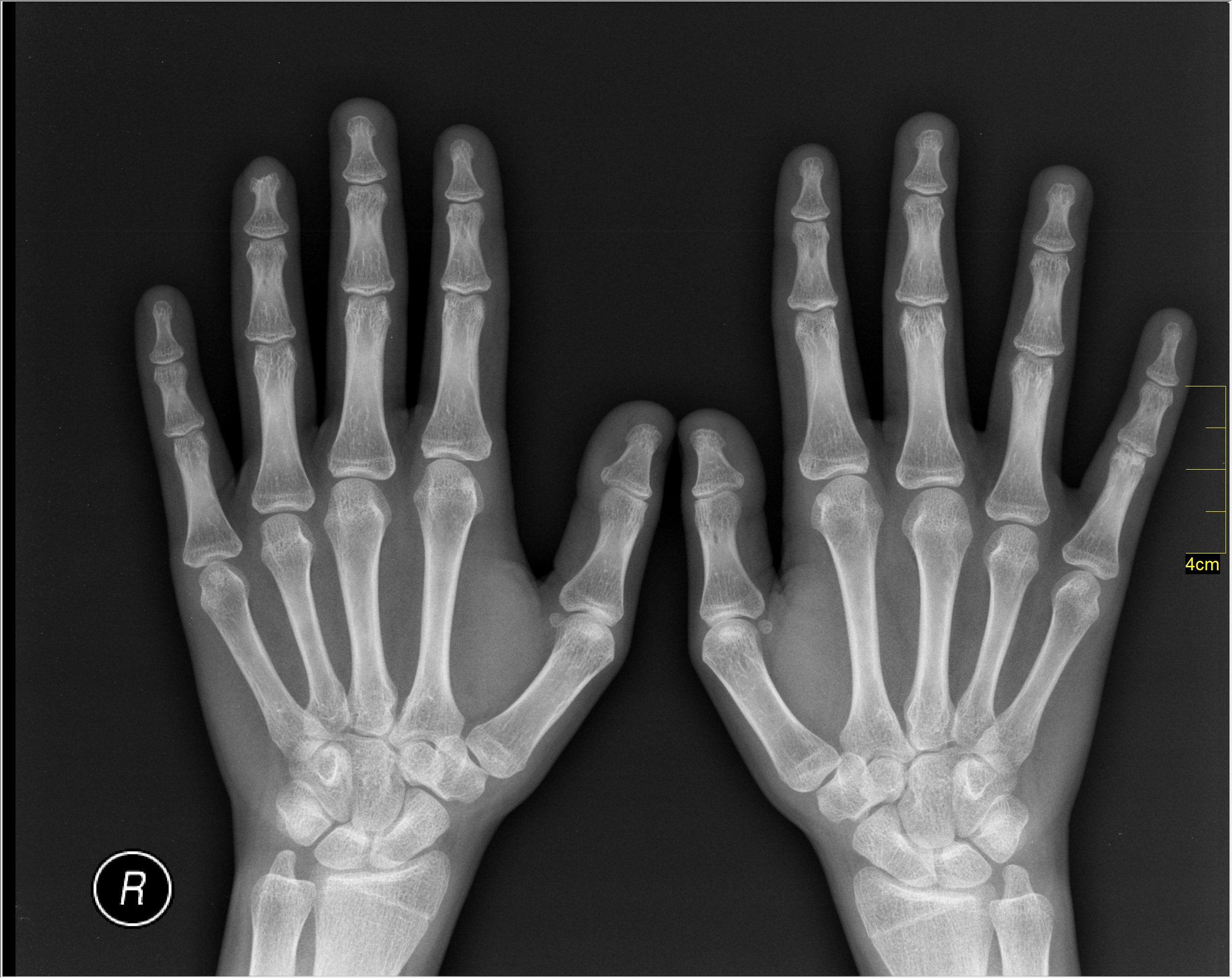 Biology Superpowers – X-Ray Vision