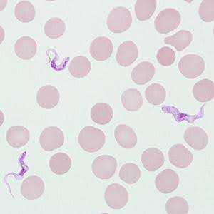 African Trypanosomes- A Weird Pathogen You Haven’t Heard Of